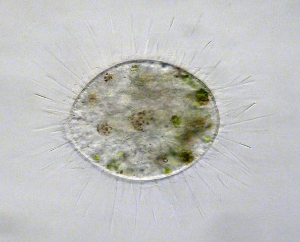 Stefansbachtal Gevelsberg Leben im Teich Einzeller (Protista